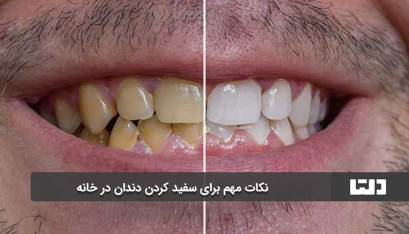 نکات مهم برای سفید کردن دندان در خانه