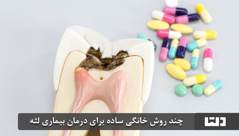 چند روش خانگی ساده برای درمان بیماری لثه