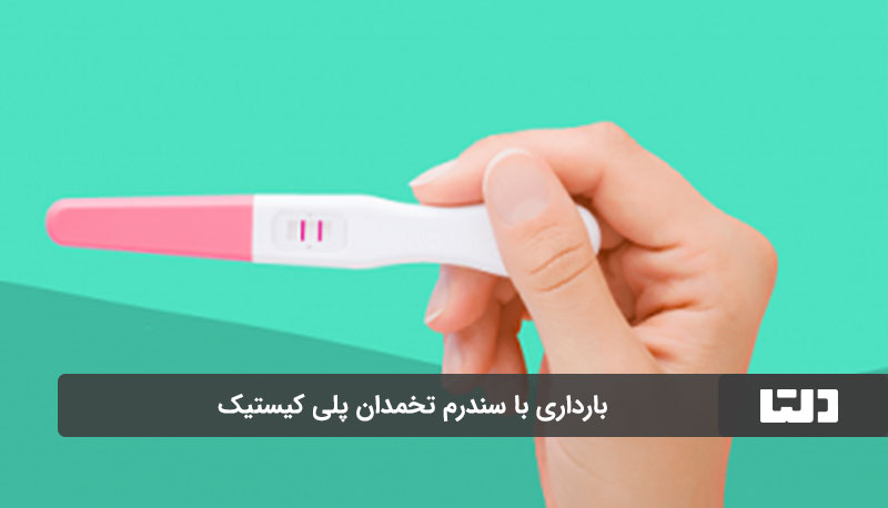 بارداری با درمان سندرم تخمدان پلی کیستیک