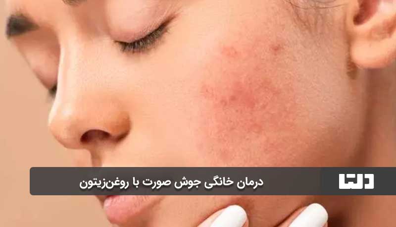 روغن درخت چای