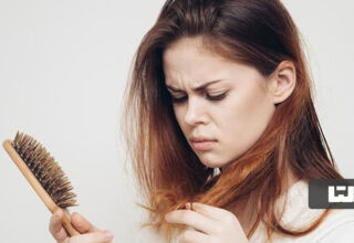 جلوگیری از ریزش مو با تغذیه مناسب