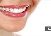روش سفید کردن دندان