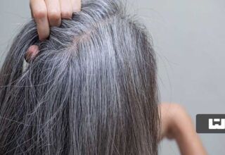 جلوگیری از سفید شدن مو با راهکارهای طبیعی