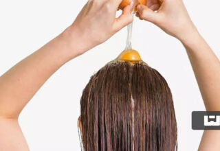 درمان ریزش مو با تخم‌مرغ