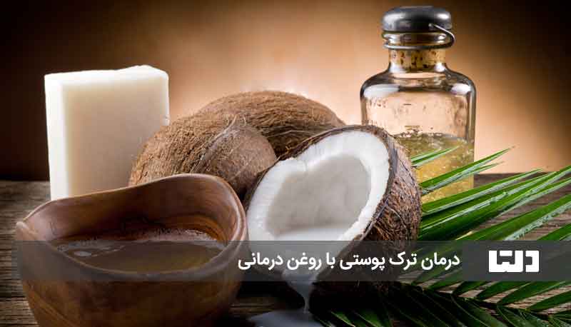 روغن درمانی