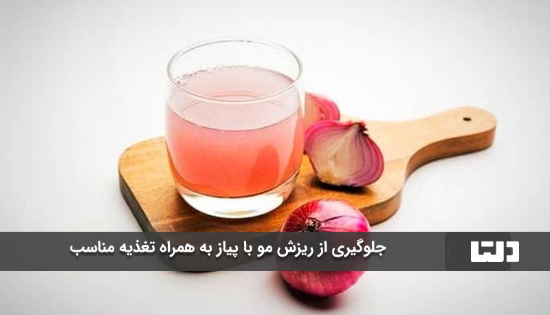 جلوگیری از ریزش مو با پیاز به همراه تغذیه مناسب