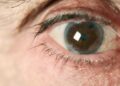 علت بوجود آمدن آب سیاه چشم -
